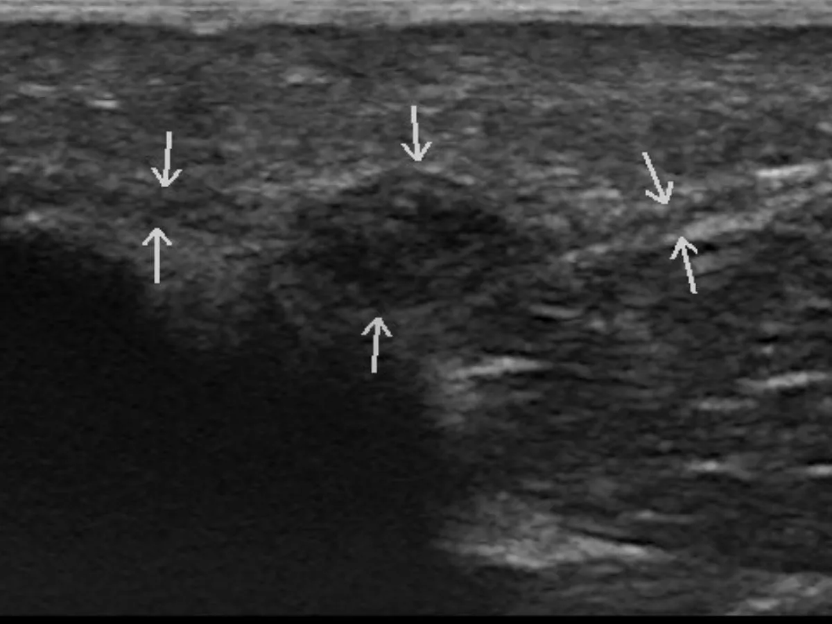 Ultrasound image