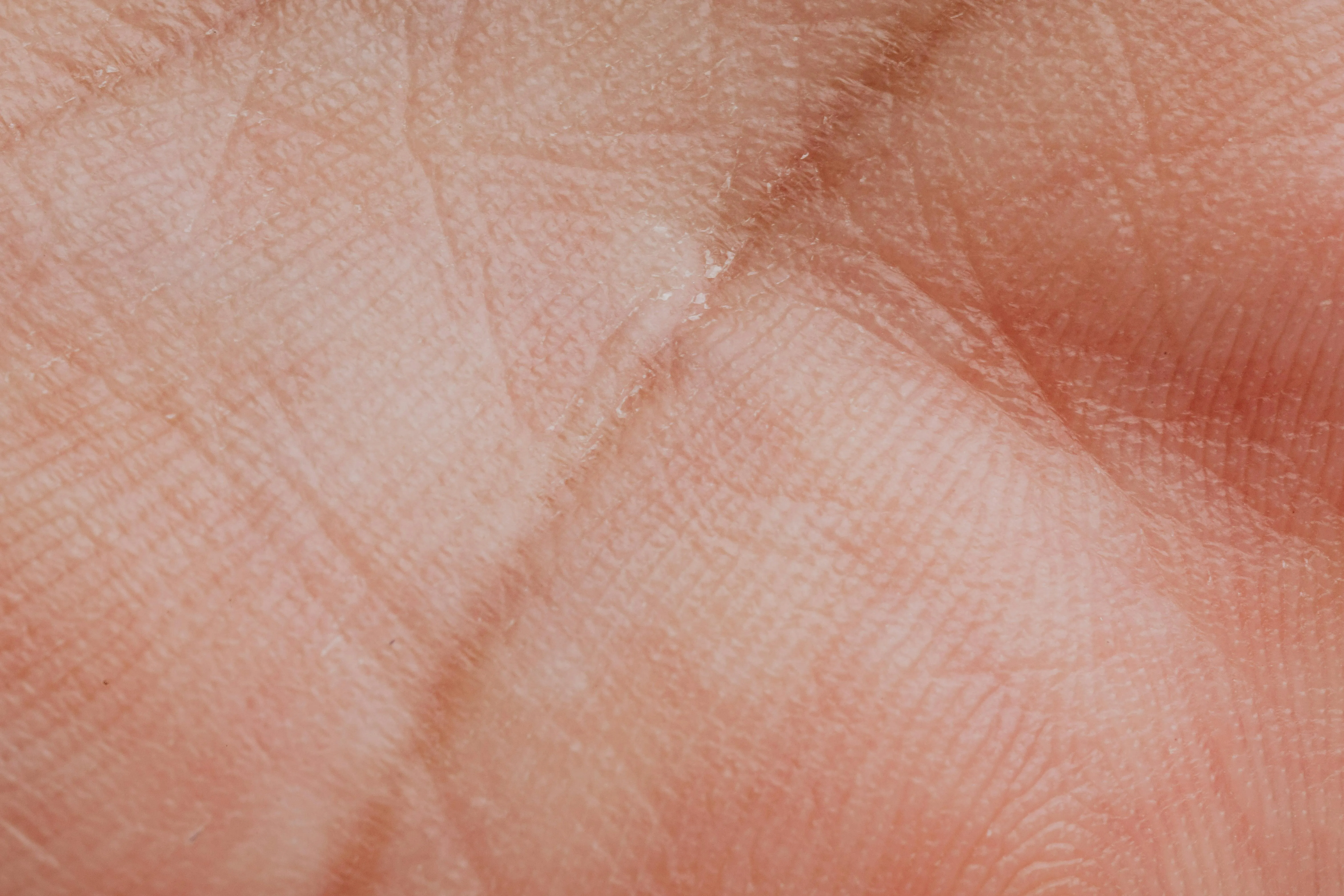 Treating special nerve conditions